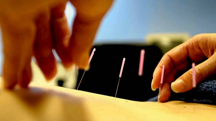 People have been advised to ask acupuncture practitioners to check on the quality of their needles if they experience pain during acupuncture. Photo: Tanya Lake
