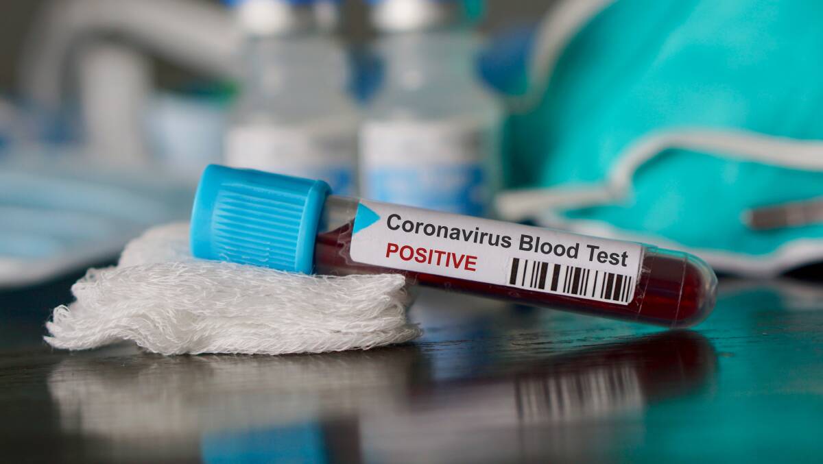 First coronavirus case confirmed in Parkes Shire